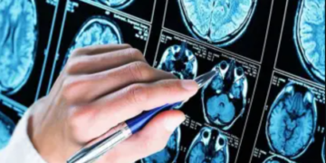 Aumentan muertes en Quintana Roo por enfermedades degenerativas