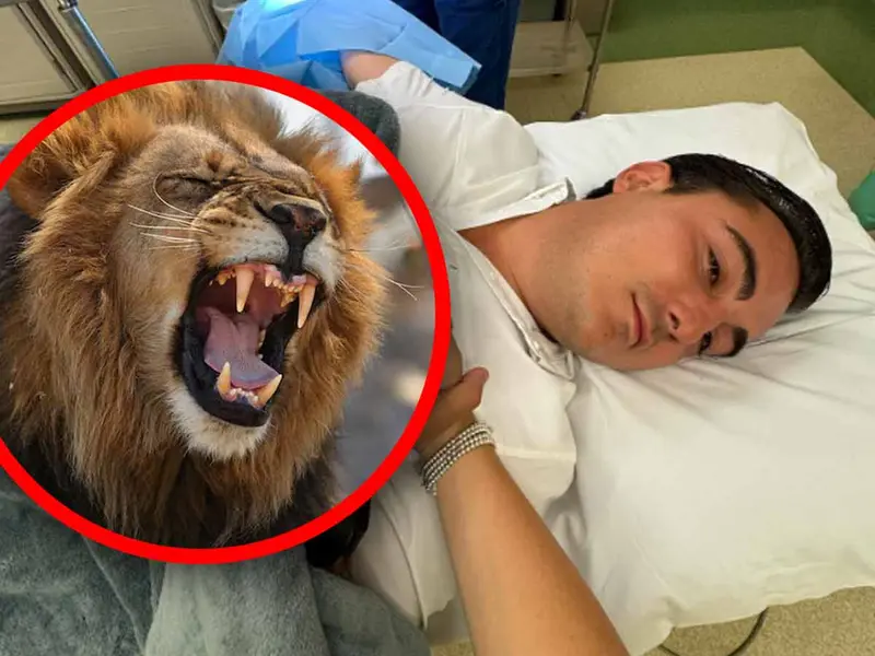 Alcalde de Nuevo León sufre la mordida de un león