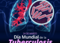 Tuberculosis en Quintana Roo: 67 casos en 2026; síntomas y prevención