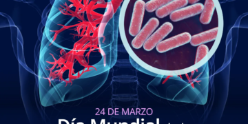 Tuberculosis en Quintana Roo: 67 casos en 2026; síntomas y prevención