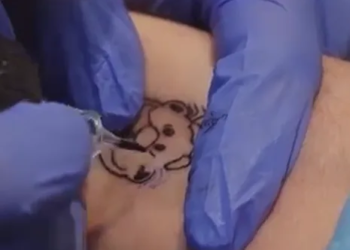 ¿Tienes tatuado al Dr. Simi? Podrías recibir dinero en efectivo