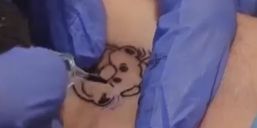 ¿Tienes tatuado al Dr. Simi? Podrías recibir dinero en efectivo